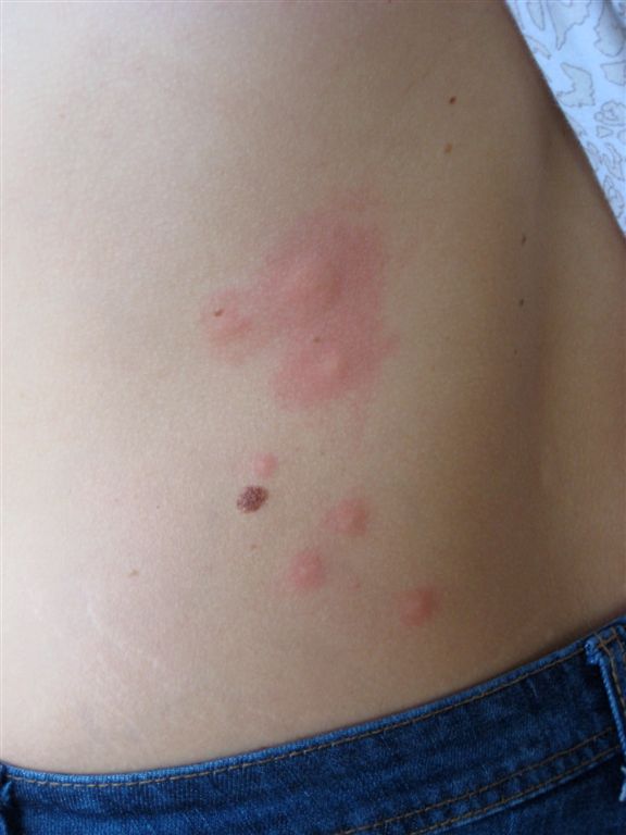 More remaining bites....